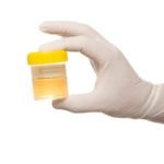 Urine Sample